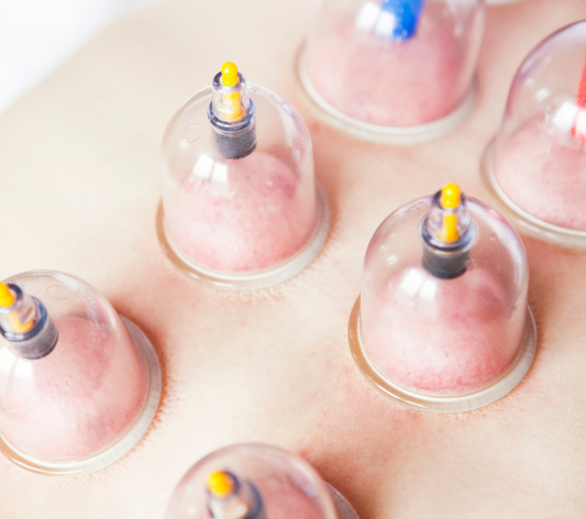 Basic Guide To Cupping Massage
